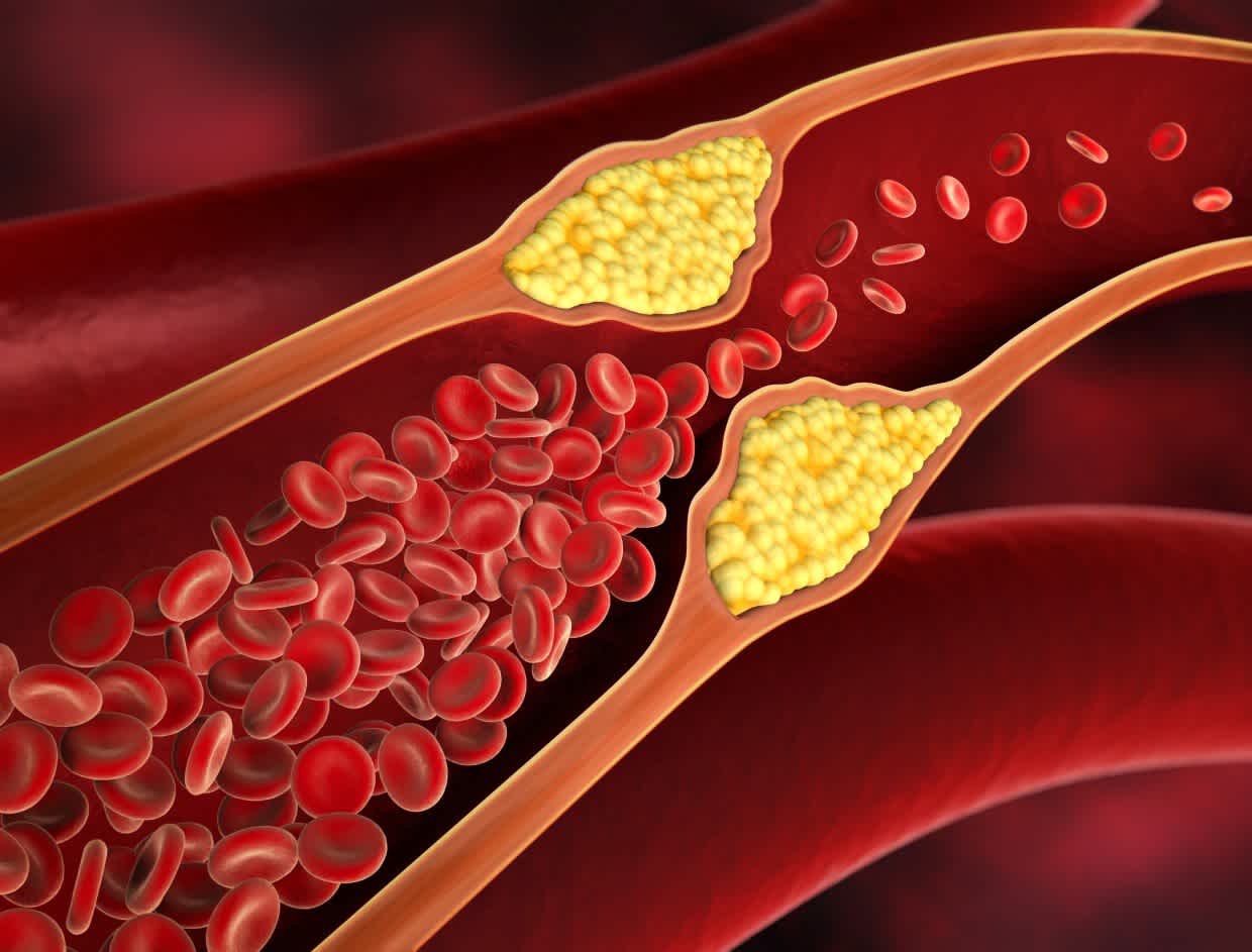 cholesterol.jpeg