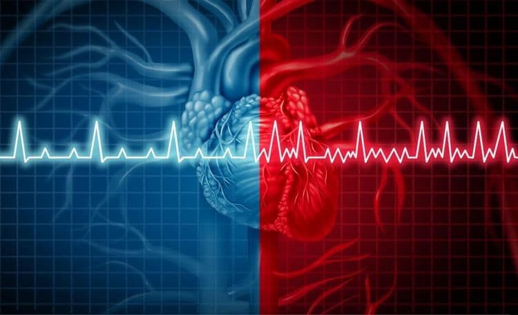 Understanding Atrial Fibrillation: Causes, Signs, Treatments, and More