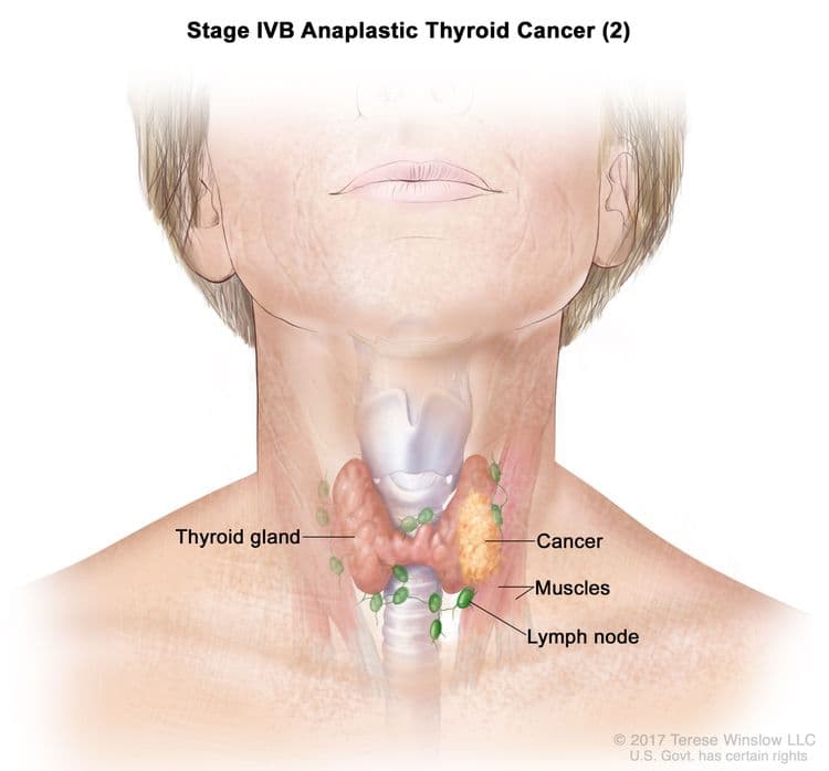 🚩 Lymphoma Red Flags: What to Look For