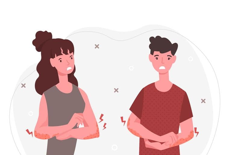First Signs of Plaque Psoriasis That You Must Know