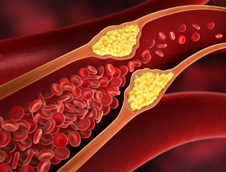 Cholesterol-Reducing Vitamins - Natural Support