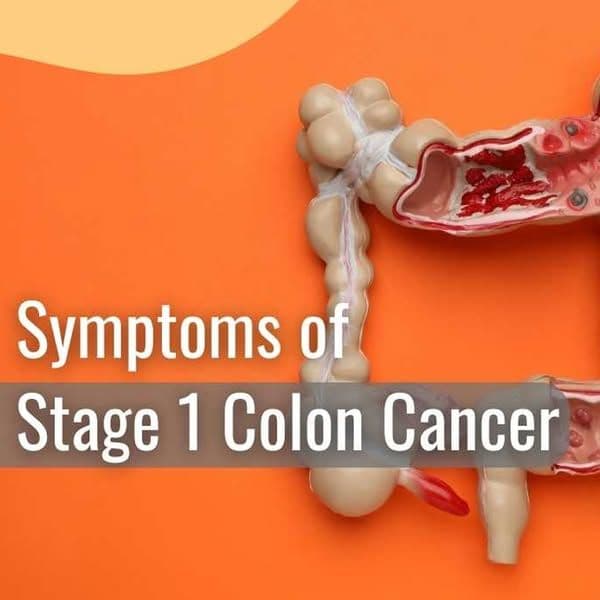 A Closer Look at Colon Cancer Symptoms